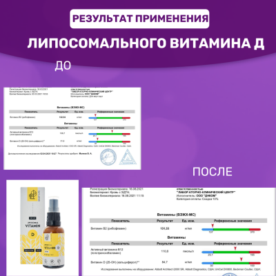 Липосомальный витамин D (30 мл.)